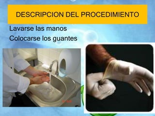 DESCRIPCION DEL PROCEDIMIENTO 
Lavarse las manos 
Colocarse los guantes 
 