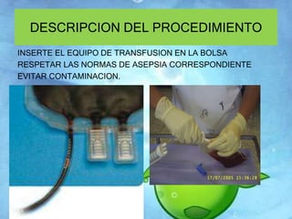 DESCRIPCION DEL PROCEDIMIENTO 
INSERTE EL EQUIPO DE TRANSFUSION EN LA BOLSA 
RESPETAR LAS NORMAS DE ASEPSIA CORRESPONDIENTE 
EVITAR CONTAMINACION. 
 