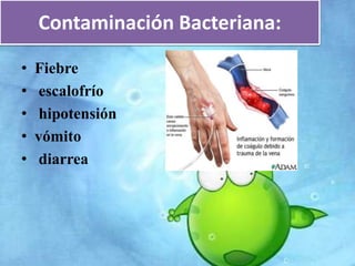 Contaminación Bacteriana: 
• Fiebre 
• escalofrío 
• hipotensión 
• vómito 
• diarrea 
 