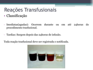 Reações Transfusionais
• Classificação
- Imediatas(agudas): Ocorrem durante ou em até 24horas do
procedimento trasfusional.
- Tardias: Surgem depois das 24horas de infusão.
Toda reação trasfusional deve ser registrada e notificada.
 