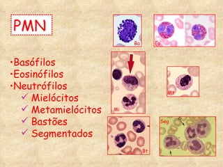 Basófilos Eosinófilos Neutrófilos Mielócitos Metamielócitos Bastões Segmentados PMN Ba Eo Mi Mt Bt Seg 