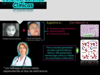 Consideraciones
Clínicas
Sugestiva a :

 Anemia megaloblastica
 Hipotiroidismo
 insuficiencia renal

+
Palidez Mucocutanea

Con relación a:

Fascie abotagada
(‘’de fruta madura’’)

Por su escasa gravedad
acuden asintomáticas.
Menos 10% presentara
hemorragia clínica y fiebre
(no asociada a infección)

* Los hallazgos clínicos varían
dependiendo el tipo de deficiencia.

 