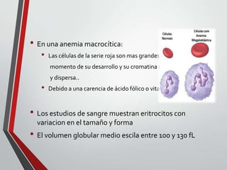 • En una anemia macrocítica:
•

Las células de la serie roja son mas grandes en cualquier
momento de su desarrollo y su cromatina nuclear es laxa
y dispersa..

•

Debido a una carencia de ácido fólico o vitamina B12.

• Los estudios de sangre muestran eritrocitos con
variacion en el tamaño y forma

• El volumen globular medio escila entre 100 y 130 fL

 
