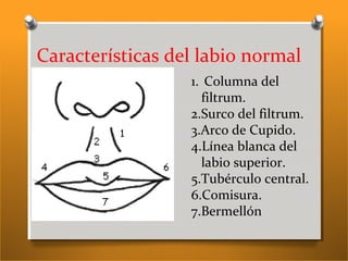 Características del labio normal
1. Columna del
filtrum.
2.Surco del filtrum.
3.Arco de Cupido.
4.Línea blanca del
labio superior.
5.Tubérculo central.
6.Comisura.
7.Bermellón
 