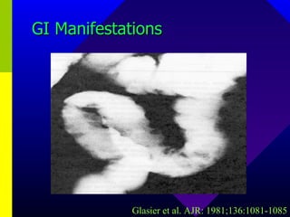 GI Manifestations Glasier et al. AJR: 1981;136:1081-1085 