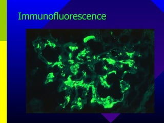 Immunofluorescence 