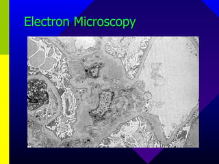 Electron Microscopy 