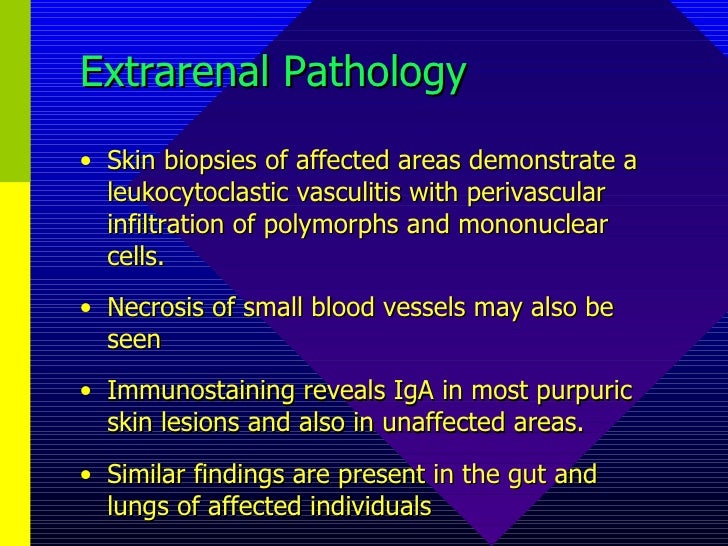 Henoch Schonlein Purpura Natural Treatment Henoch Schonlein Purpura Natural Treatment
