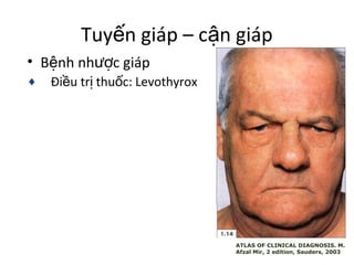 Tuyến giáp – cận giáp 
• Bệnh nhược giáp 
¨ Điều trị thuốc: Levothyrox 
ATLAS OF CLINICAL DIAGNOSIS. M. 
Afzal Mir, 2 edition, Sauders, 2003 
 