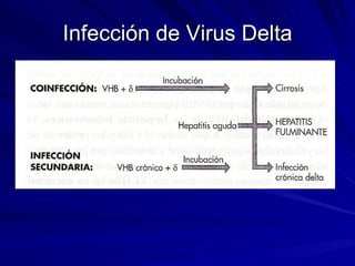 Infección de Virus Delta 