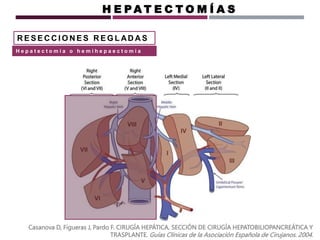 R E S E C C I O N E S R E G L AD A S
Casanova D, Figueras J, Pardo F. CIRUGÍA HEPÁTICA. SECCIÓN DE CIRUGÍA HEPATOBILIOPANCREÁTICA Y
TRASPLANTE. Guías Clínicas de la Asociación Española de Cirujanos. 2004.
H E P A T E C T O M Í A S
H e p a t e c t o m i a o h e m i h e p a e c t o m i a
 