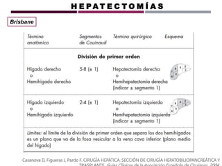 Casanova D, Figueras J, Pardo F. CIRUGÍA HEPÁTICA. SECCIÓN DE CIRUGÍA HEPATOBILIOPANCREÁTICA Y
H E P A T E C T O M Í A S
Brisbane
 