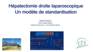 Daniel Cherqui
Centre Hépato-Biliaire
Hôpital Paul Brousse – Unversité Paris Saclay
Hépatectomie droite laparoscopique
Un modèle de standardisation
 