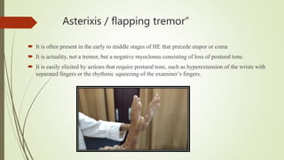 Asterixis / flapping tremor”
 It is often present in the early to middle stages of HE that precede stupor or coma
 It is actuality, not a tremor, but a negative myoclonus consisting of loss of postural tone.
 It is easily elicited by actions that require postural tone, such as hyperextension of the wrists with
separated fingers or the rhythmic squeezing of the examiner’s fingers.
 