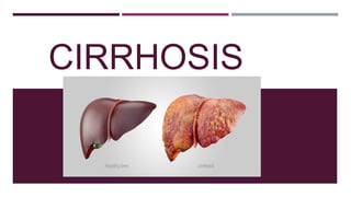 CIRRHOSIS
 