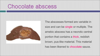 Chocolate abscess
The abscesses formed are variable in
size and can be single or multiple. The
amebic abscess has a necrotic central
portion that contains a thick, reddish
brown, pus-like material. This material
has been likened to chocolate sauce.
 