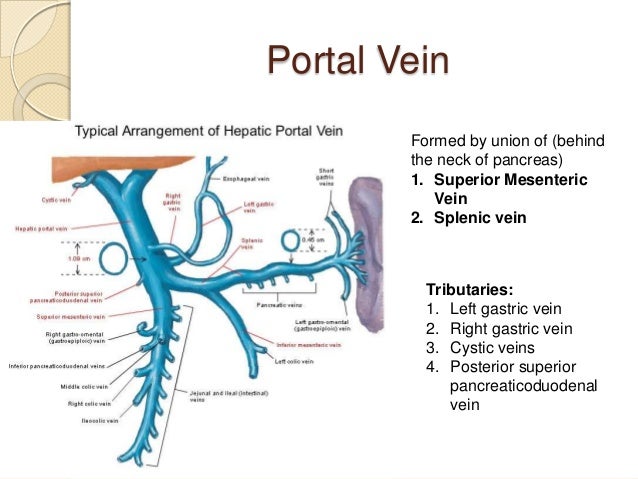 portacaval anastomosis