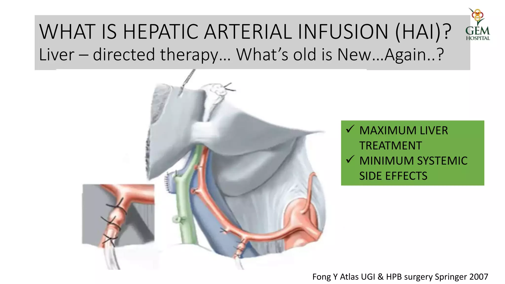HEPATIC ARTERIAL INFUSION PUMP CHEMOTHERAPY IN HCC AND IHCC.pptx