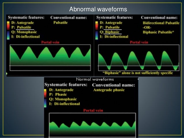 Hepatic doppler