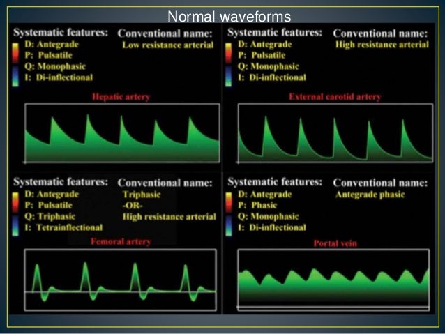 Hepatic doppler ultrasound