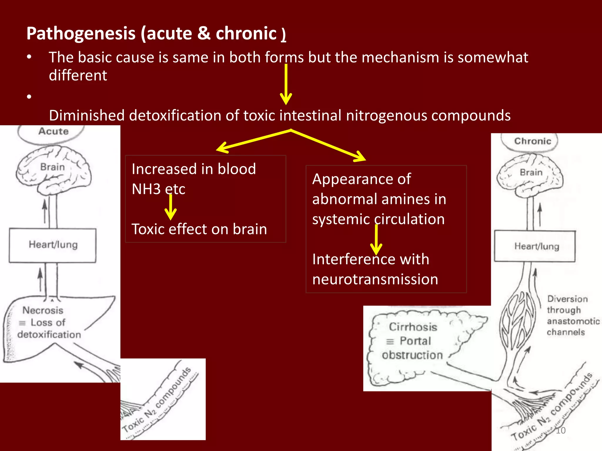 Pathogenesis (acute & chronic )
• The basic cause is same in both forms but the mechanism is somewhat
different
•
Diminished detoxification of toxic intestinal nitrogenous compounds
Increased in blood
NH3 etc
Toxic effect on brain
Appearance of
abnormal amines in
systemic circulation
Interference with
neurotransmission
10
 