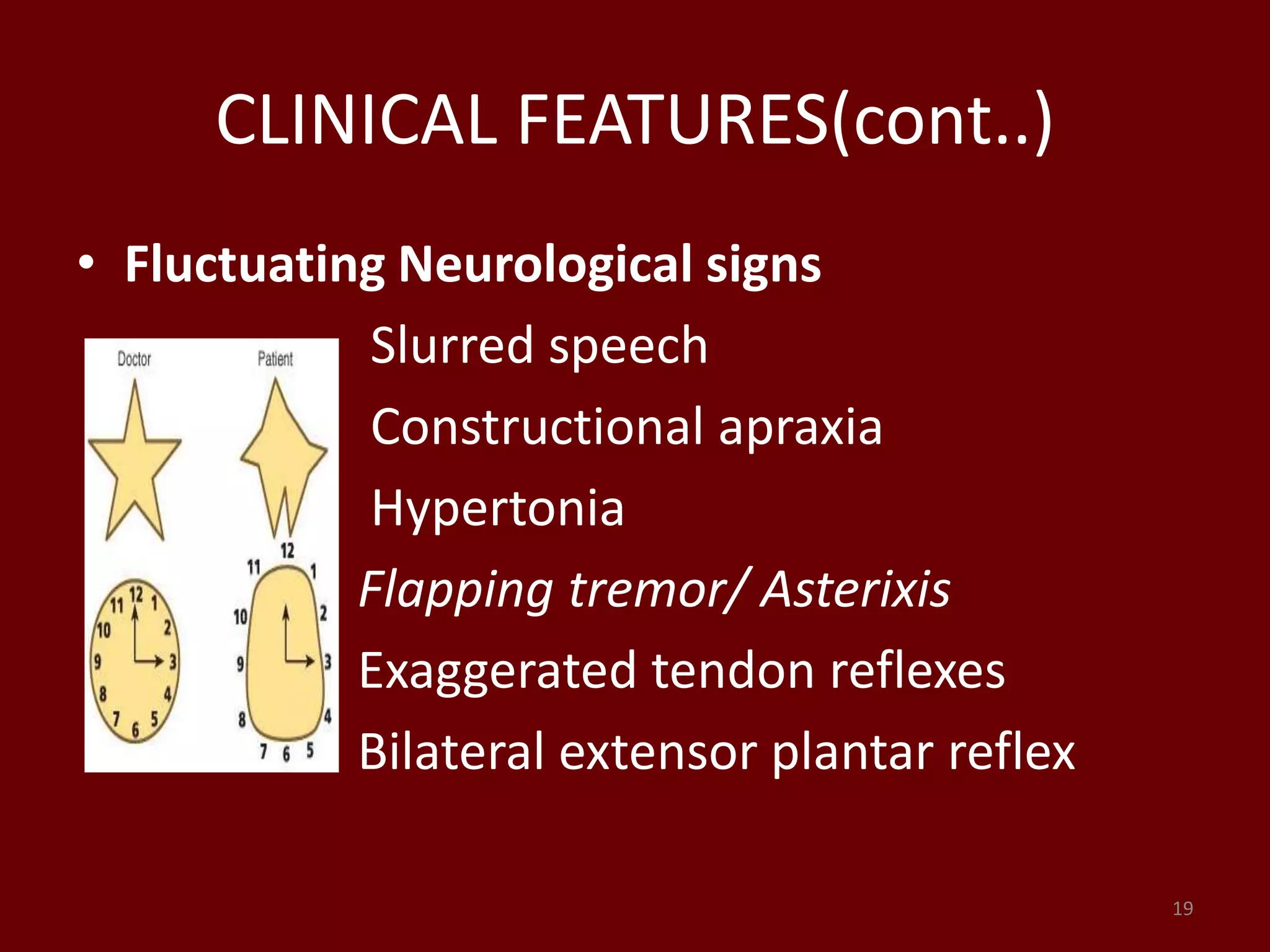 CLINICAL FEATURES(cont..)
• Fluctuating Neurological signs
Slurred speech
Constructional apraxia
Hypertonia
Flapping tremor/ Asterixis
Exaggerated tendon reflexes
Bilateral extensor plantar reflex
19
 