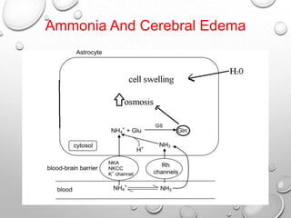 Ammonia And Cerebral Edema

 