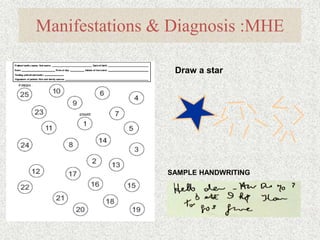 Manifestations & Diagnosis :MHE 
Number Connection Test (NCT) 
1 
2 
4 
3 
5 
6 
7 
8 
9 
10 
11 
12 
13 
14 
15 16 
17 
18 
19 20 
21 
25 
22 
23 
24 
Begin 
End 
Time to 
complete____________________ 
Draw a star 
SAMPLE HANDWRITING 
 