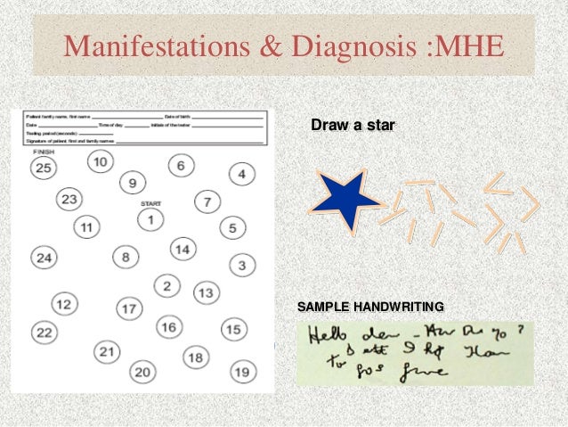 handwriting diagnostic test Hepatic encephalopathy handwriting diagnostic test Hepatic encephalopathy