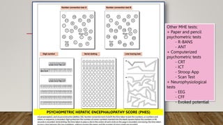 PSYCHOMETRIC HEPATIC ENCEPHALOPATHY SCORE (PHES)
Other MHE tests:
+ Paper and pencil
psychometric tests
- R-BANS
- ANT
+ Computerized
psychometric tests
- CRT
- ICT
- Stroop App
- Scan Test
+ Neurophysiological
tests
- EEG
- CFF
- Evoked potential
 