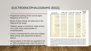 ELECTROENCEPHALOGRAMS (EEGS)
• Progressive slowing of the normal alpha
frequency of 8 to13 Hz
• Bursts of slow activity are observed in the
theta (4–8 Hz) range
• Triphasic waves or arrhythmic delta activity
occur with more severe grades of
encephalopathy
• Coma is characterized by slow, low-voltage
delta activity with sequences of electric
silence
• Abnormalities of the EEG are reported in 43
to 100% of patients with overt HE and in 8
to 40% of clinically unimpaired patients with
cirrhosis
 