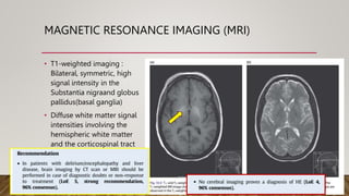 MAGNETIC RESONANCE IMAGING (MRI)
• T1-weighted imaging :
Bilateral, symmetric, high
signal intensity in the
Substantia nigraand globus
pallidus(basal ganglia)
• Diffuse white matter signal
intensities involving the
hemispheric white matter
and the corticospinal tract
on T2-weighted imaging
 