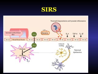 SIRS
 