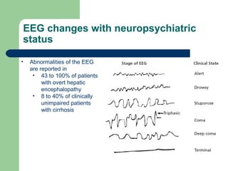 EEG changes with neuropsychiatric
status
• Abnormalities of the EEG
are reported in
• 43 to 100% of patients
with overt hepatic
encephalopathy
• 8 to 40% of clinically
unimpaired patients
with cirrhosis
 