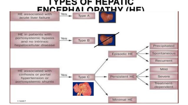 paracetamol history symposium Hepatic encephalopathy presentation paracetamol history symposium Hepatic encephalopathy presentation