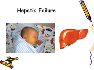 Hepatic Failure
 