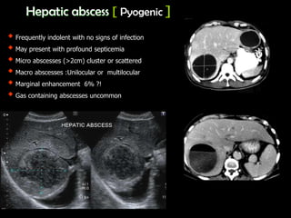 Hepatic imaging | PPTX