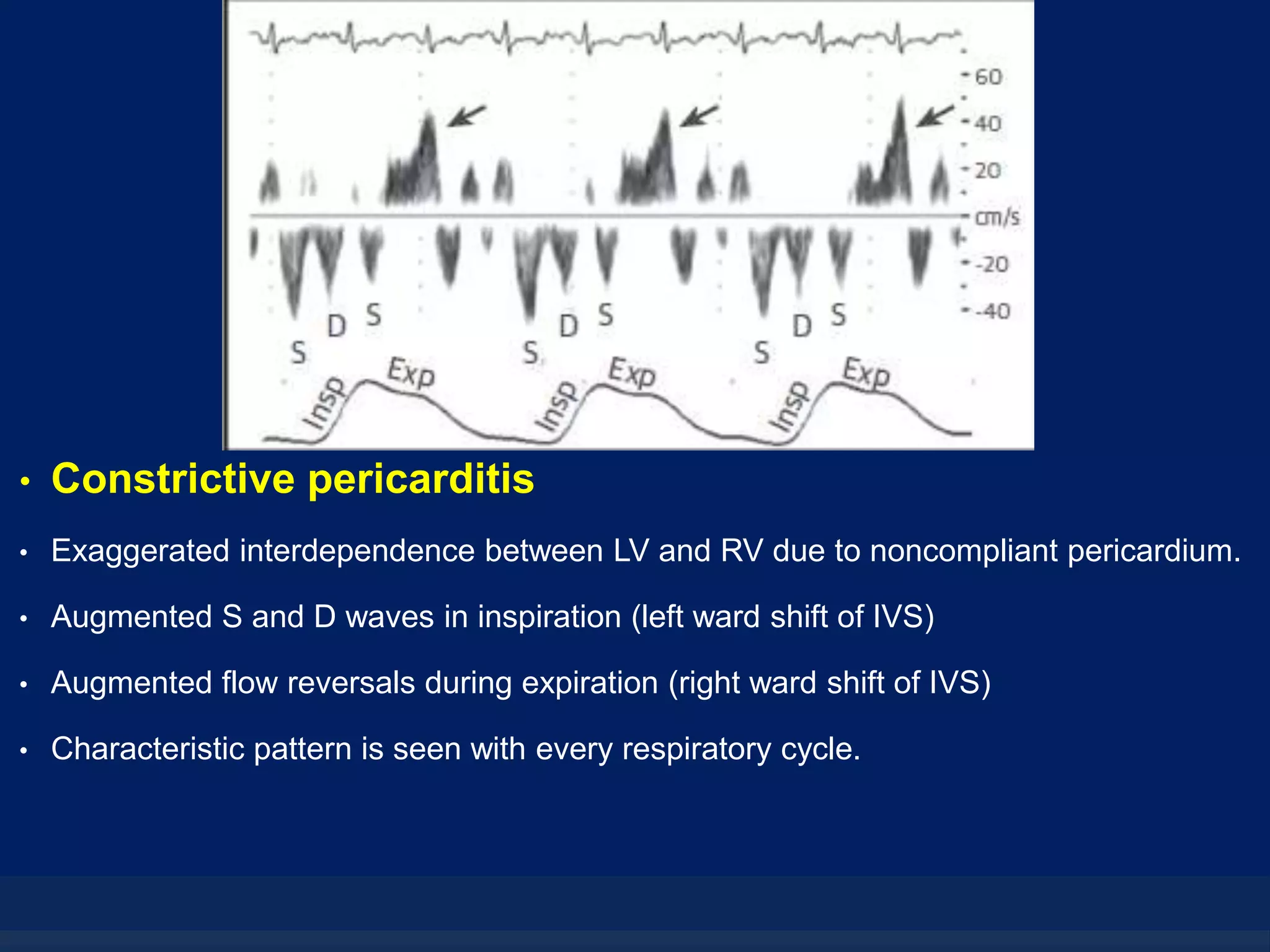 Hepatic veins - The Doppler interrogation | PPTX