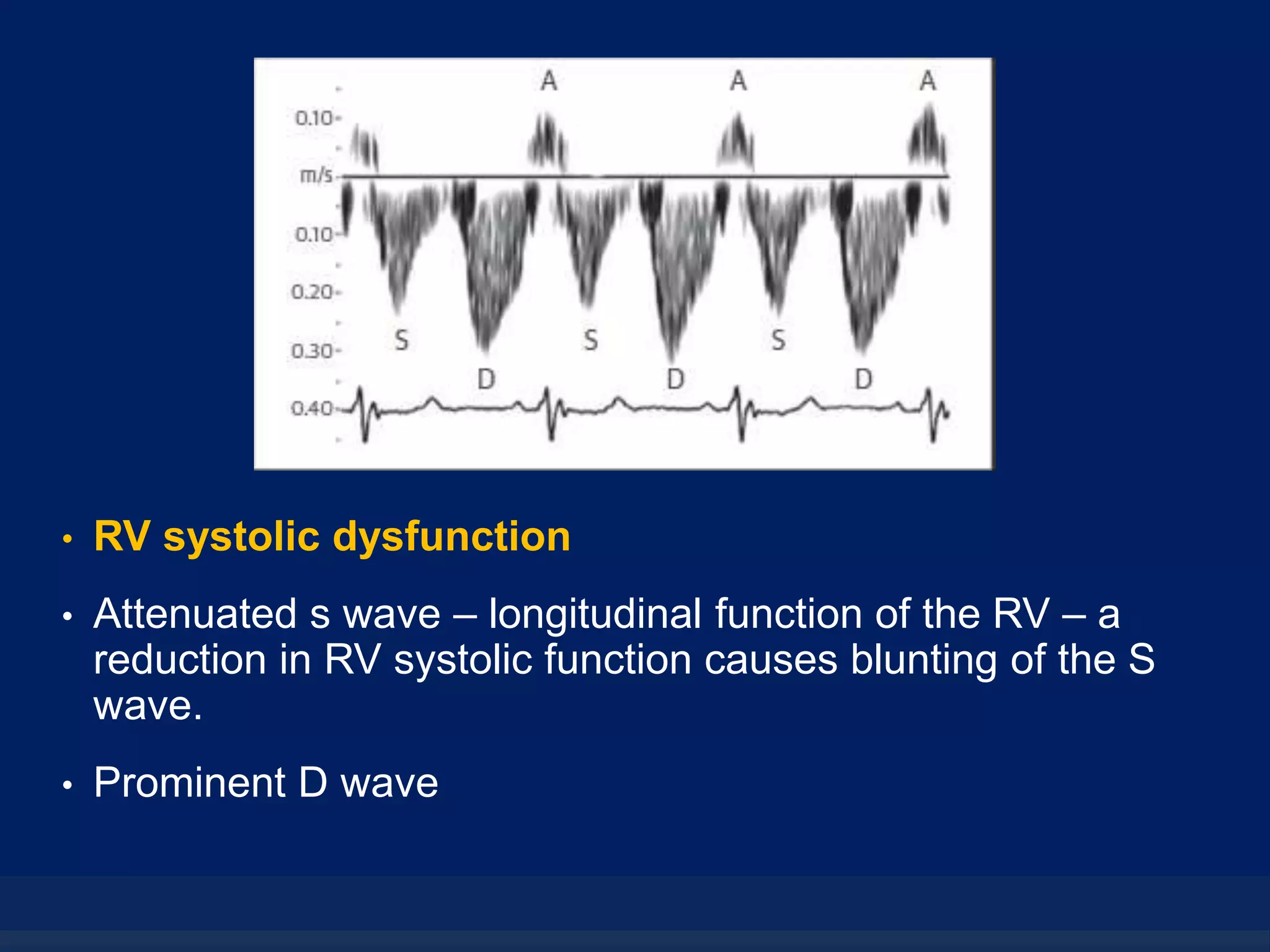 Hepatic veins - The Doppler interrogation | PPTX