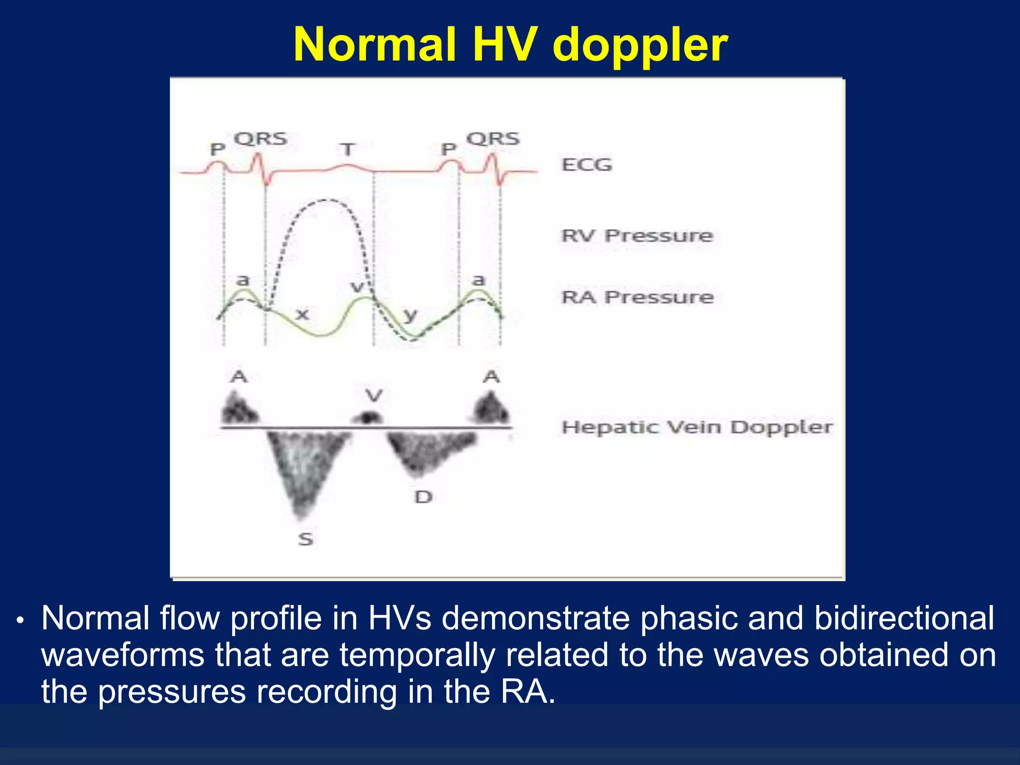 Hepatic veins - The Doppler interrogation | PPTX