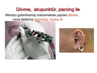 Dövme,  akupunktür, piercing ile  Mikrobu giderilmemiş malzemelerle yapılan  dövme,   vücut deldirme  (piercing), hızma vb 