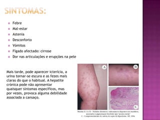 Podem provocar danos permanentes na saúde dos indivíduos sem mostrarem qualquer sintoma.  Hepatite BA hepatite B é tramitida para o ser humano através de vários métodos e que depois pode progredir para cirrose hepática ou cancro do fígado (hepatocarcinoma); O vírus da hepatite D é um vírus que: só ataca células já infectadas pelo HBV piorando o estado de saúde dos doentes infectados com o vírus hepatite B crónica.
