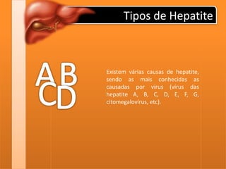 Tipos de Hepatite
Existem várias causas de hepatite,
sendo as mais conhecidas as
causadas por vírus (vírus das
hepatite A, B, C, D, E, F, G,
citomegalovírus, etc).
 