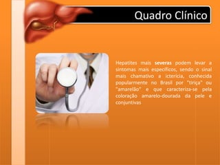 Quadro Clínico
Hepatites mais severas podem levar a
sintomas mais específicos, sendo o sinal
mais chamativo a icterícia, conhecida
popularmente no Brasil por "tiriça" ou
"amarelão" e que caracteriza-se pela
coloração amarelo-dourada da pele e
conjuntivas
 