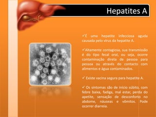 Quadro ClínicoAssociado pode ocorrer urina cor de coca-cola (colúria) e fezes claras, tipo massa de vidraceiro (acolia fecal). 