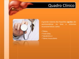 Quadro ClínicoA grande maioria das hepatites agudas são assintomáticas ou leva a sintomas incaracterísticos como:febre, 
