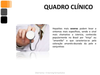 QUADRO CLÍNICO


                     Hepatites mais severas podem levar a
                     sintomas mais específicos, sendo o sinal
                     mais chamativo a icterícia, conhecida
                     popularmente no Brasil por "tiriça" ou
                     "amarelão" e que caracteriza-se pela
                     coloração amarelo-dourada da pele e
                     conjuntivas




Click Farma – E-learning farmacêutico
 