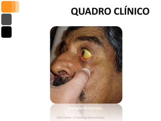 QUADRO CLÍNICO




        Exemplo de icterícia

Click Farma – E-learning farmacêutico
 