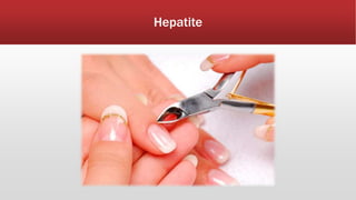 Hepatite 
 