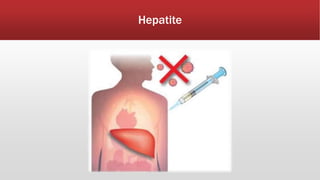 Hepatite 
 